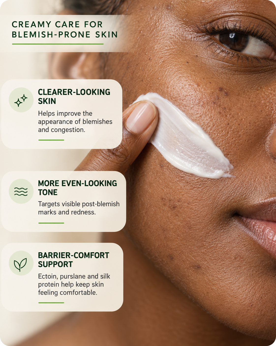 Acne & Dark Spots Face Cream
