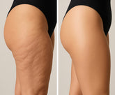 Before and after comparison of a thigh showing reduced cellulite and smoother skin after using Moisture Essence Body Oil.